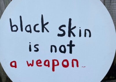 Black Skin Is Not A Weapon