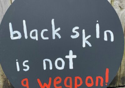 Black Skin Is Not A Weapon